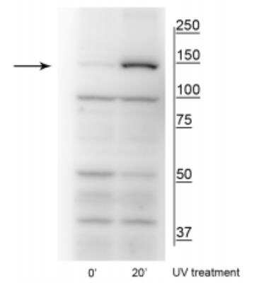 Western Blot: FANCI [p Ser556] Antibody [NBP2-60780]